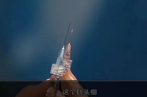 教你一分钟辨别真假玻尿酸